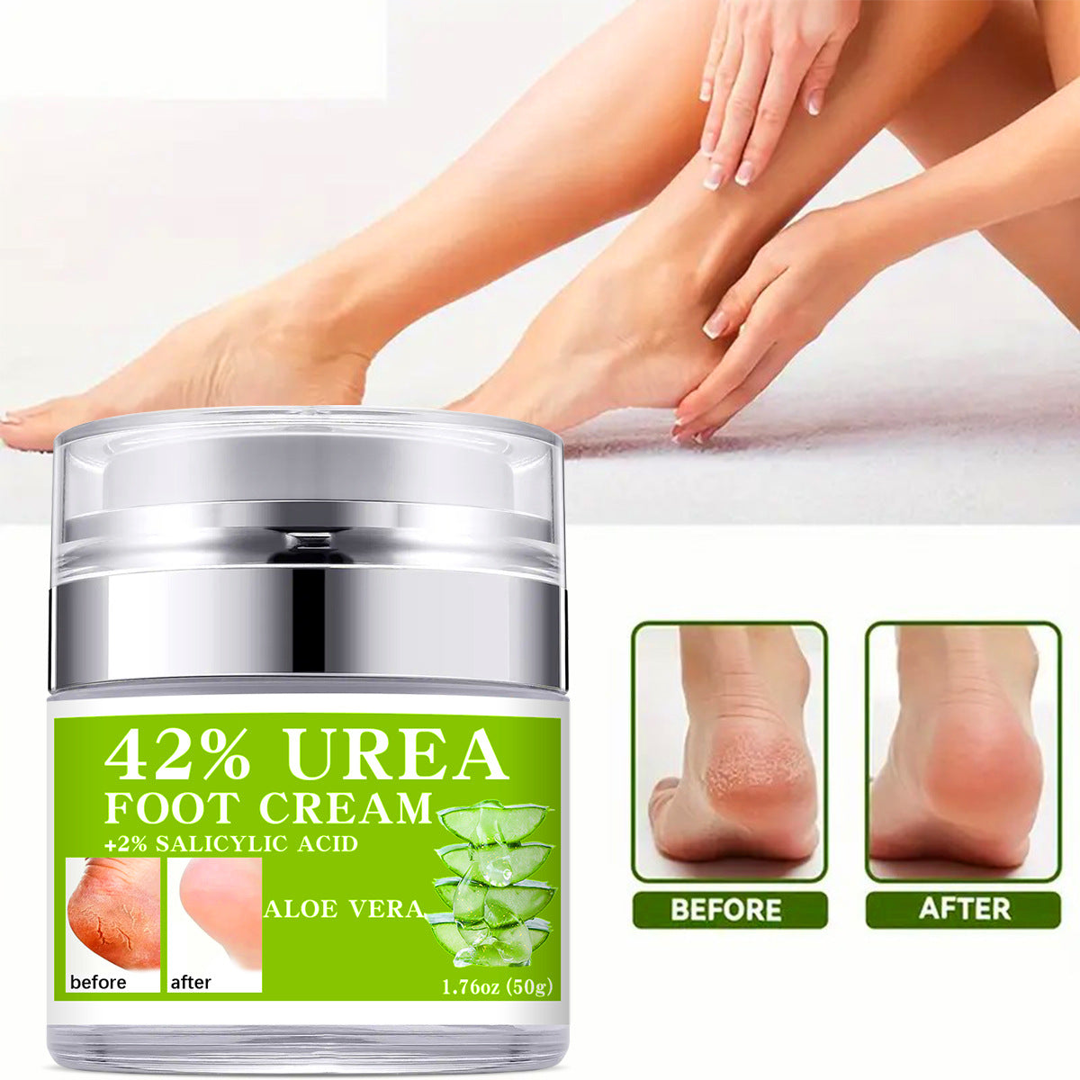 42% Urea Hand & Foot Cream - Intensive Moisturizing Body Lotion, Hydrating Care for Dry & Cracked Skin